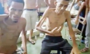 Các tù nhân Venezuela chỉ còn da bọc xương